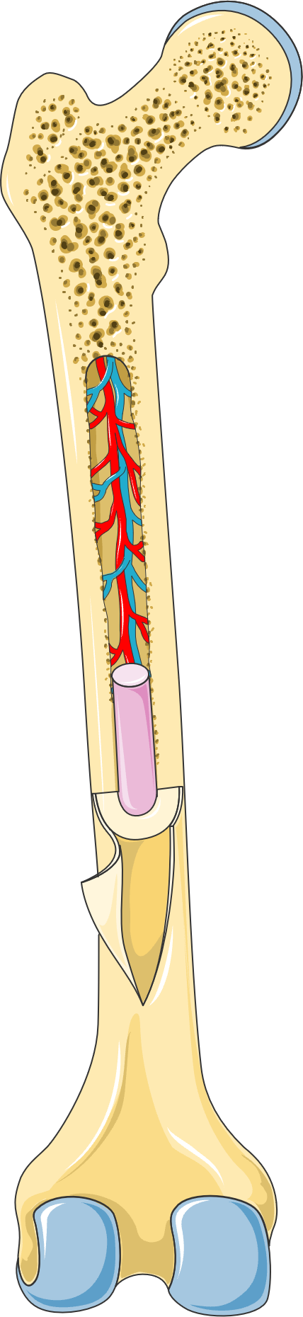 Illustration of the femur bone — proximal long bones can harbor POEMS sclerotic lesions