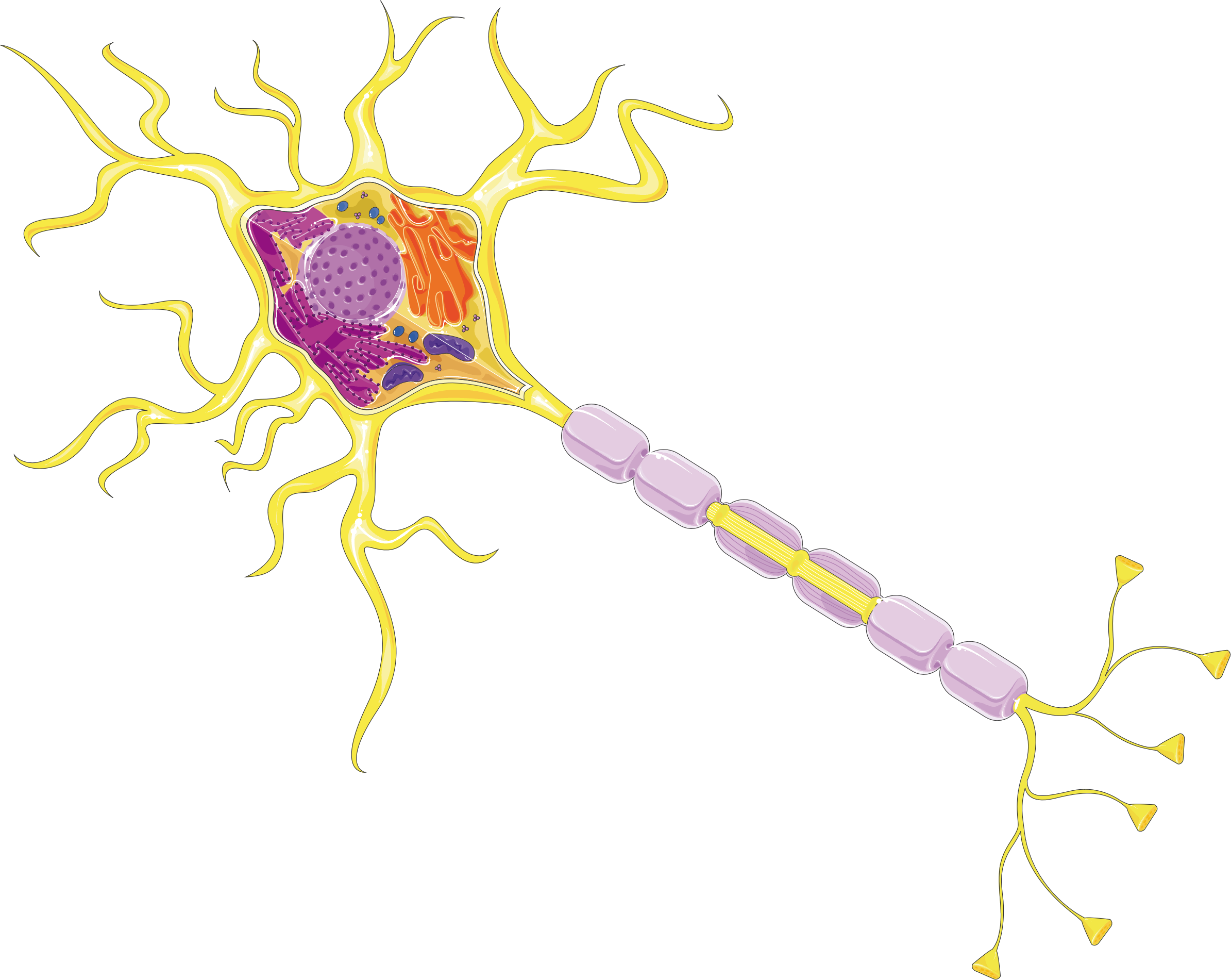 Illustration of a neuron (nerve cell) showing the cell body, axon, and myelin sheath — the structure damaged in POEMS polyneuropathy